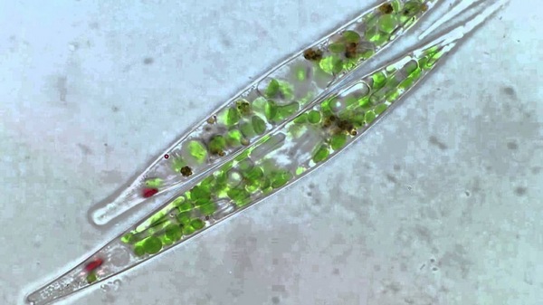 Евглена зелена під мікроскопом